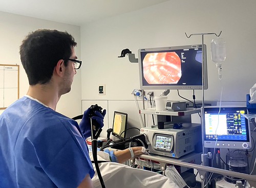 La endoscopia avanzada transforma el tratamiento del cáncer de colon en fases iniciales